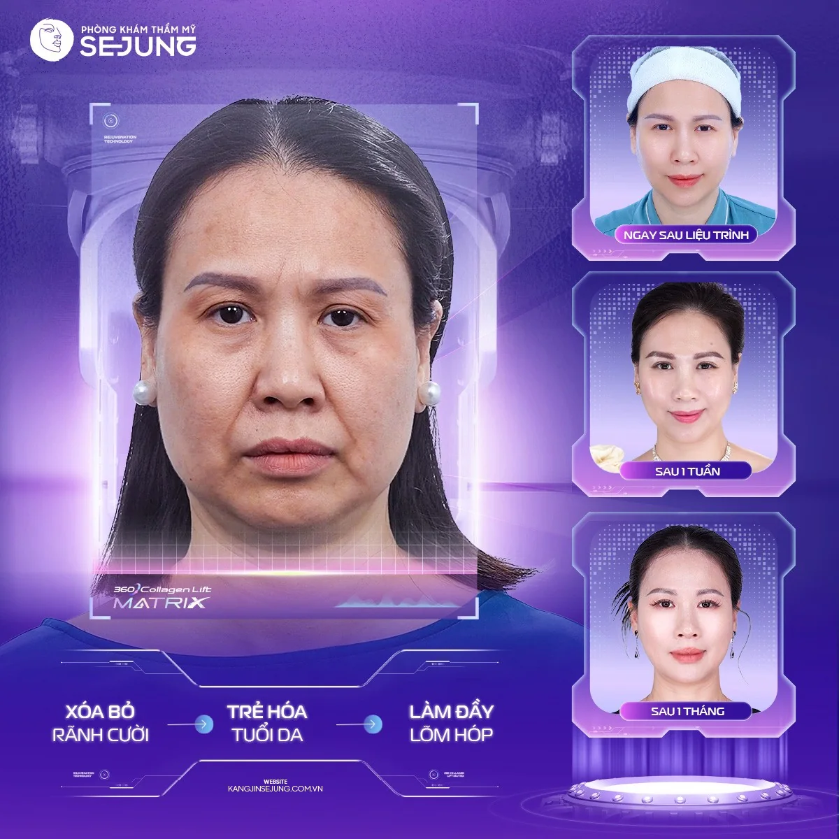 Bản sao của BA_Tú-Hảo
